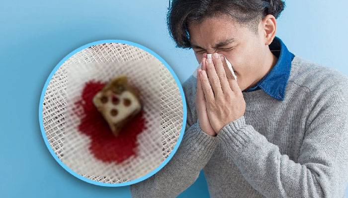 Chinese man discovers dice in nose after 20 years of sneezing