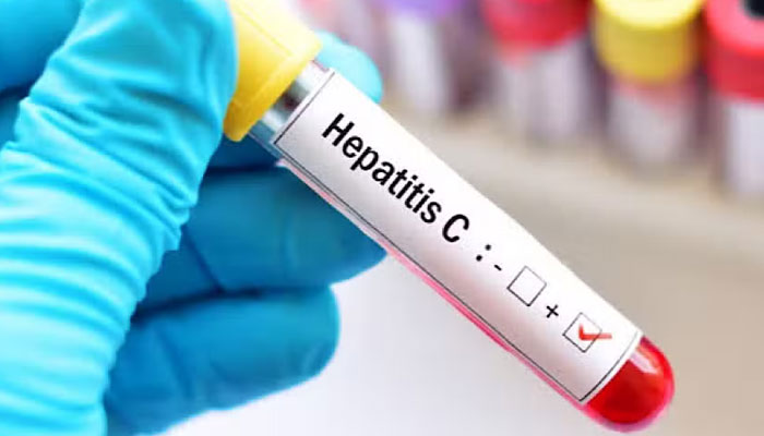 Pakistan Faces Hepatitis C Crisis with Highest Global Cases, Warns Health Official