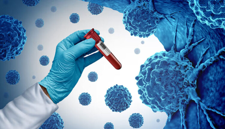 Cancer Treatment Trial Shows Promising Early Results